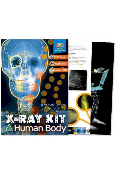 X-Ray Kit Human Body